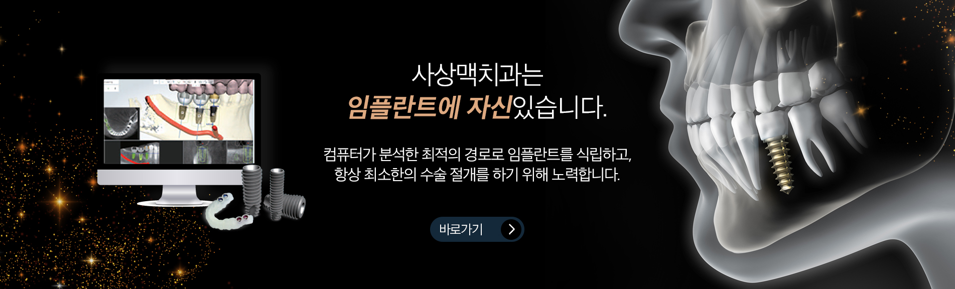 컴퓨터 식립 계획 화면과 임플란트·수술 가이드 모형으로 디지털 임플란트를 설명하는 이미지