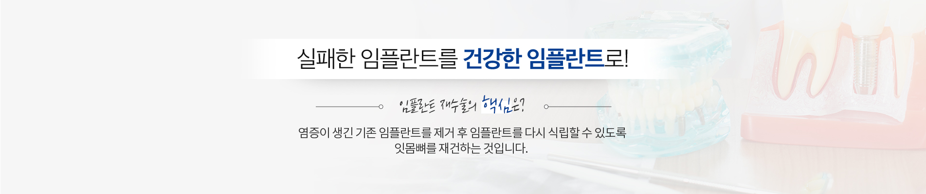 임플란트 재수술 진료 안내 이미지 2: 재수술을 고려하는 경우. 임플란트 주위염: 임플란트 주변 잇몸이 붓고 고름이 나오거나 뼈가 녹는 경우. 동요·통증: 임플란트가 흔들리거나 씹을 때 통증이 지속되는 경우. 식립 위치 문제: 위치나 각도가 부적절해 보철이나…