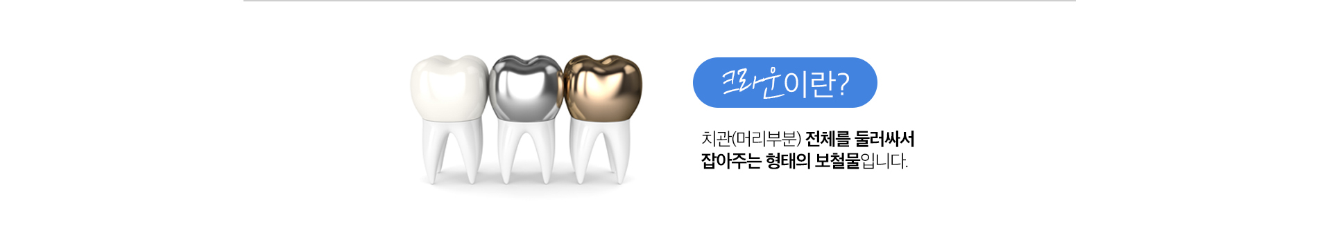 크라운 보철 치료 진료 안내 이미지 2: 크라운 재료. 지르코니아: 강도와 심미성이 우수해 앞니·어금니에 폭넓게 사용됩니다. 도자기(PFM): 금속 안쪽에 도자기를 입혀 강도와 자연스러움을 모두 얻습니다. 금: 치아와 밀착도가 높고 부드러워 강한 힘을 받는…