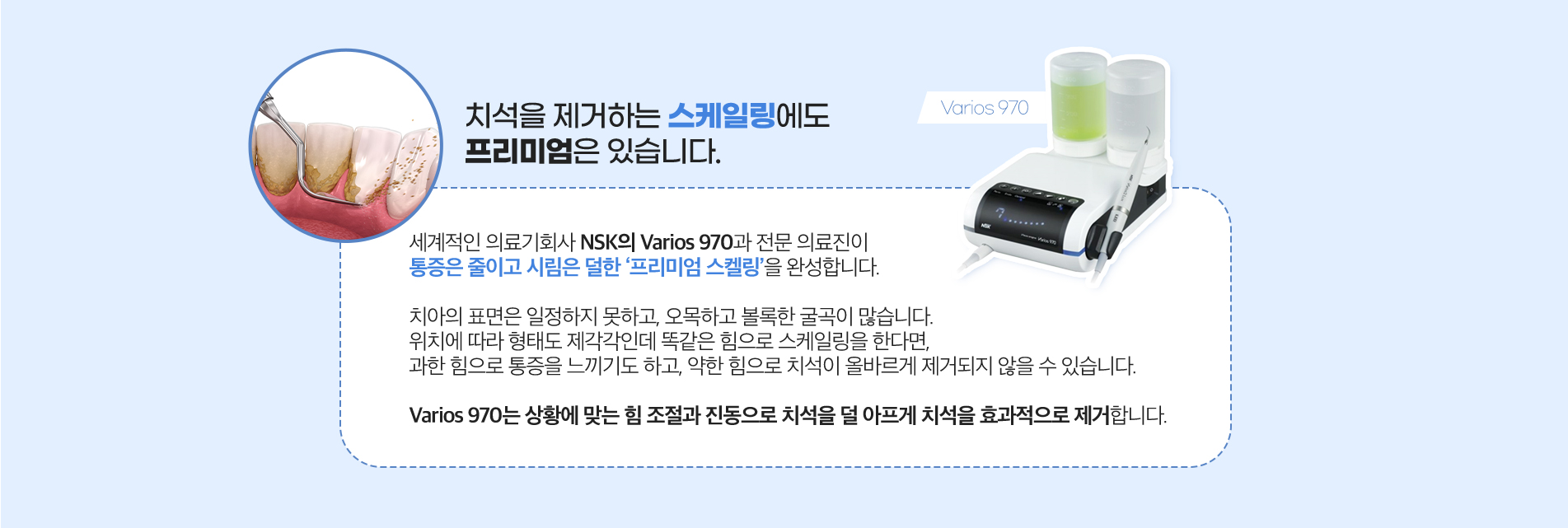 스케일링 진료 안내 이미지 2: 이런 분께 권장합니다. 칫솔질할 때 잇몸에서 피가 자주 나는 경우 입냄새가 신경 쓰이는 경우 잇몸이 붓거나 붉게 변한 경우 치아 사이나 잇몸 경계에 누런 침착물이 보이는 경우 1년 이상 스케일링을 받지 않은 경우