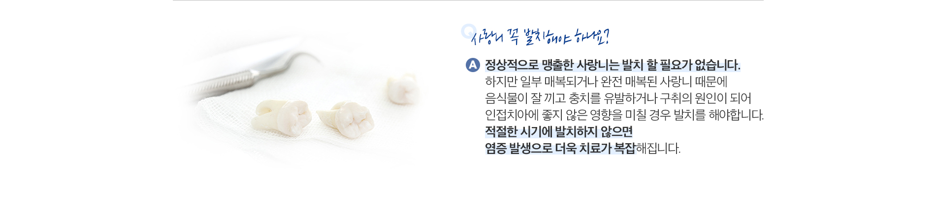 사랑니 발치 진료 안내 이미지 2: 발치를 권해드리는 경우. 반복되는 통증·부종: 사랑니 주변 잇몸이 자주 붓고 아픈 지치주위염이 반복되는 경우. 청결 관리가 어려운 위치: 칫솔이 닿지 않아 사랑니 또는 앞 어금니에 충치가 생기는 경우. 비스듬한 매복…