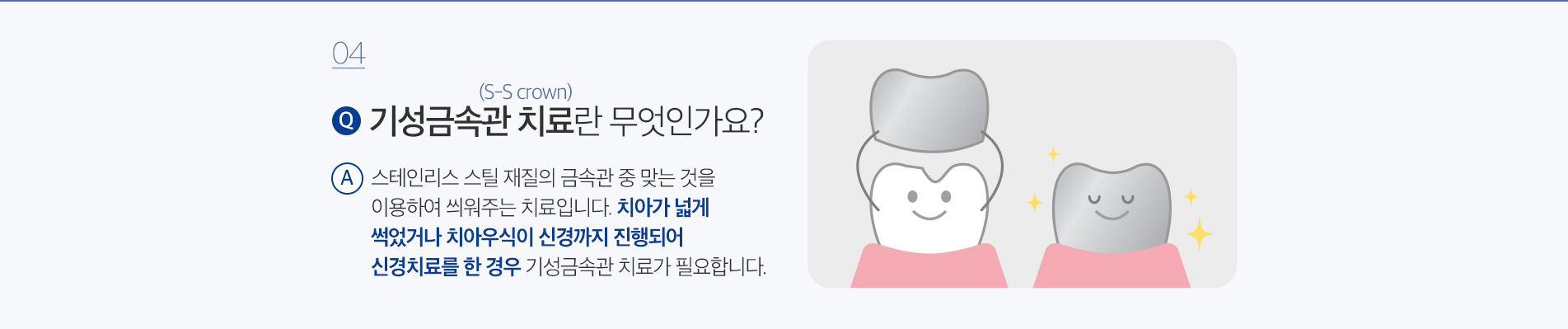 소아치료 진료 안내 이미지 7: 진료 안내. 첫 치과 방문은 통증이 없을 때가 좋습니다. 예방 검진으로 시작하면 아이가 치과를 편안하게 받아들입니다.