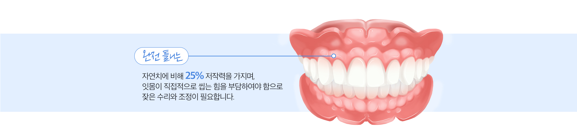 완전 틀니 진료 안내 이미지 2: 완전 틀니의 역할. 저작 기능 회복: 음식을 다시 씹을 수 있어 영양 섭취와 소화에 도움이 됩니다. 발음 개선: 앞니 지지로 새는 발음을 줄여 대화가 편해집니다. 얼굴 인상 회복: 꺼진 입가와 볼을 받쳐 젊고 자연스러운…