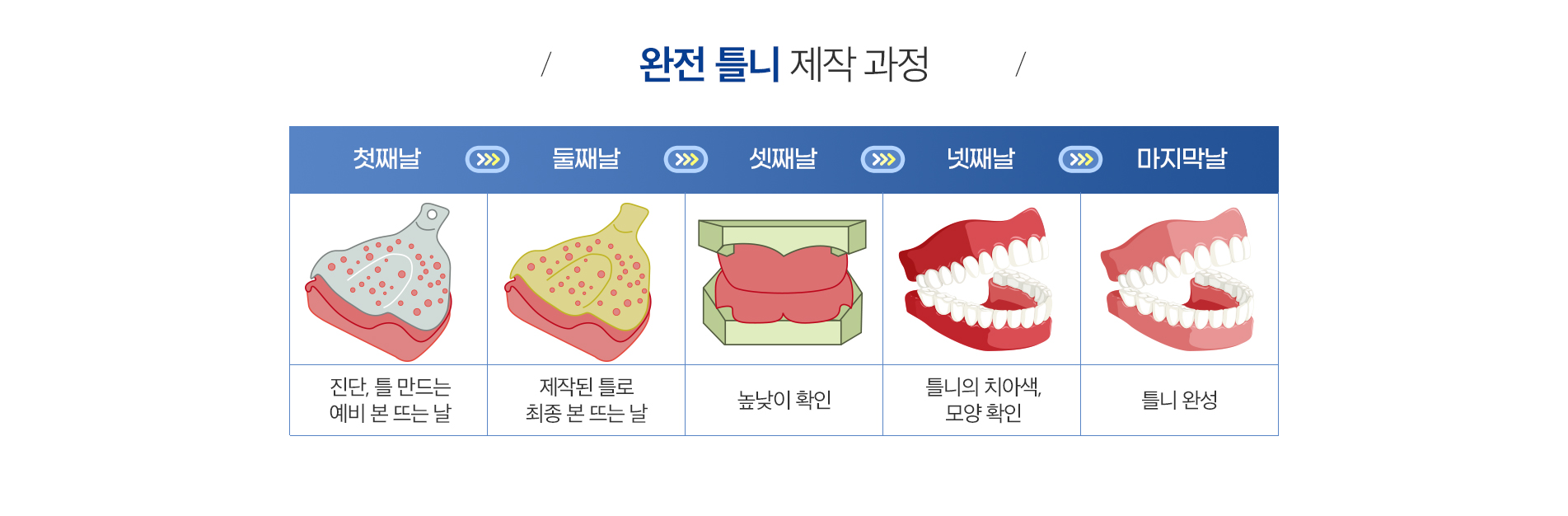 완전 틀니 진료 안내 이미지 3: 제작 과정. 01 진단·상담: 잇몸과 구강 상태를 확인하고 치료 계획을 세웁니다. 02 정밀 인상: 잇몸을 정밀하게 본떠 밀착이 잘 되는 틀을 만듭니다. 03 교합 채득: 위아래 물림 높이와 위치를 기록합니다. 04…