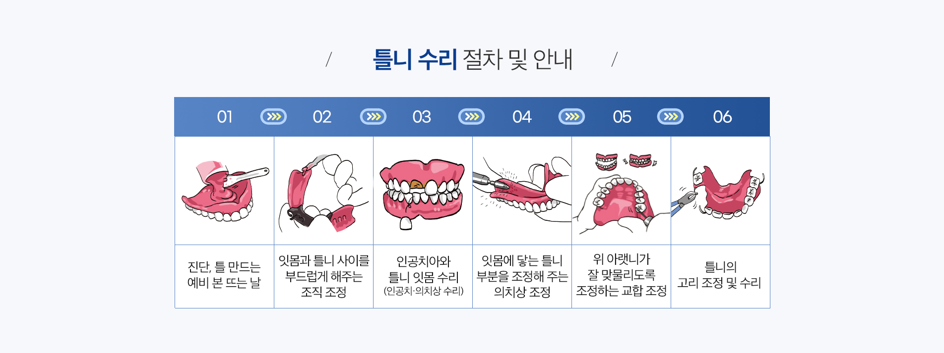 완전 틀니 진료 안내 이미지 4: 자주 묻는 질문. 질문: 적응 기간이 얼마나 걸리나요? 답변: 개인차가 있으나 보통 몇 주간 조정과 적응 과정을 거치며 점차 편해집니다. 질문: 음식은 무엇이든 씹을 수 있나요? 답변: 처음엔 부드러운 음식부터 시작해…